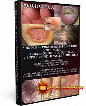 metodiki-izlechenija-ot-gribkovyx-zabolevanij-kozhnyx-i-vnutrennix-porazhenij-frolov.20052.jpg